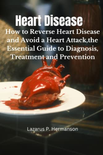 Heart Disease: How to Reverse Heart Disease and Avoid a Heart Attack,the Essential Guide to Diagnosis, Treatment and Prevention