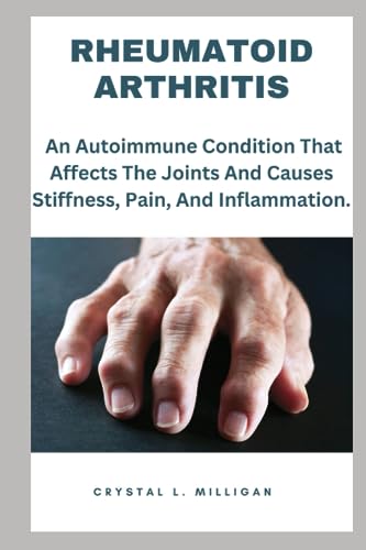 RHEUMATOID ARTHRITIS: An Autoimmune Condition That Affects The Joints And Causes Stiffness, Pain, And Inflammation.