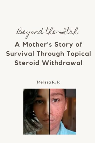 Beyond the Itch: A Mother's Story of Survival Through Topical Steroid Withdrawal