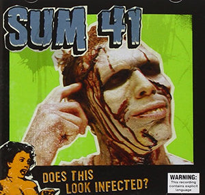 SUM 41 DOES THIS LOOK INFECTED