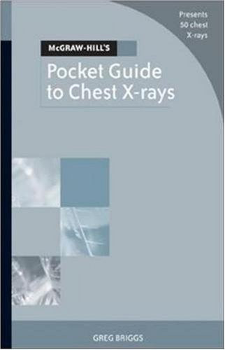 McGraw-Hill's Pocket Guide to Chest X-rays