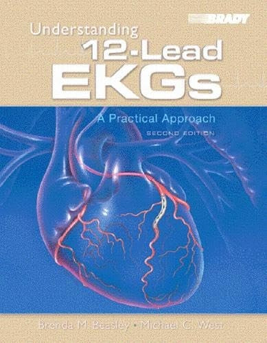 Understanding 12-Lead EKGs