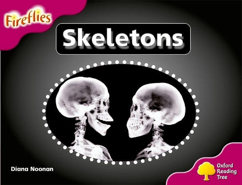 Oxford Reading Tree: Level 10: Fireflies: Skeletons