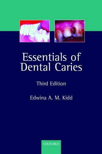 Essentials of Dental Caries