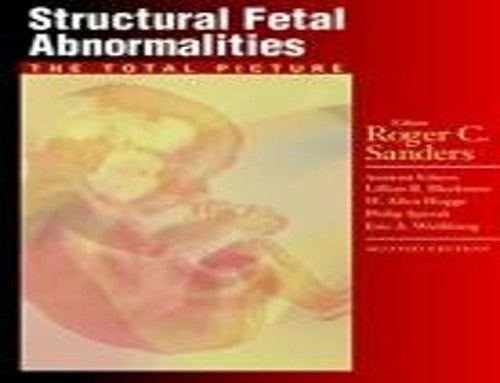 Structural Fetal Abnormalities
