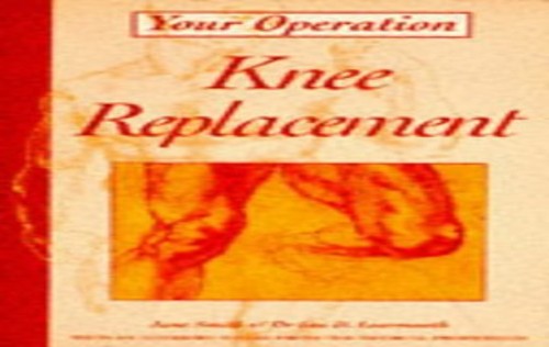 Knee Replacement