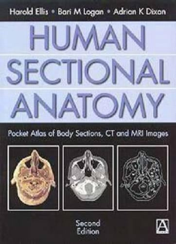 Human Sectional Anatomy, 2Ed