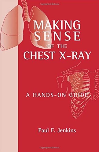 Making Sense of the Chest X-ray