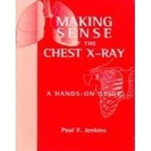 Making Sense of the Chest X-Ray Ise a Hands-on Guide 