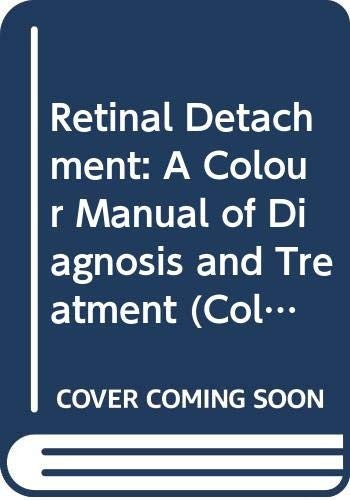 Retinal Detachment