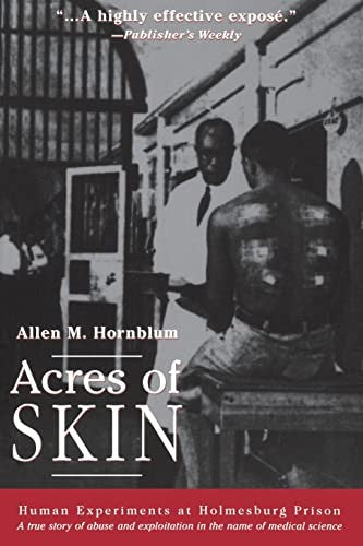 Acres of Skin