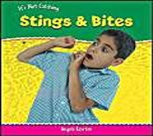 It's Not Catching: Stings And Bites