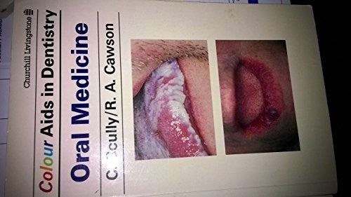 Colour Aids in Oral Medicine