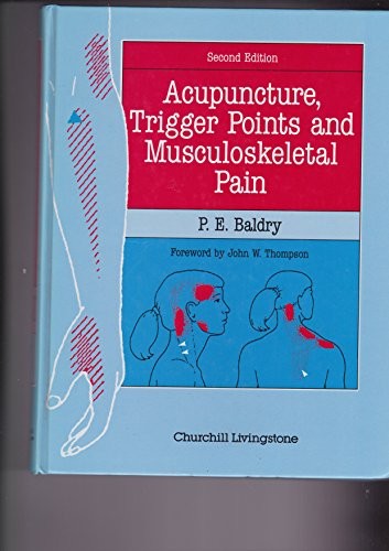 Acupuncture, Trigger Points and Musculoskeletal Pain