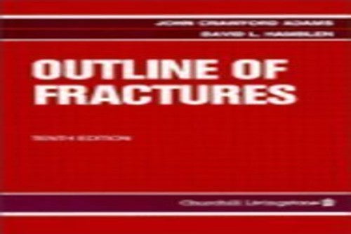 Outline of Fractures