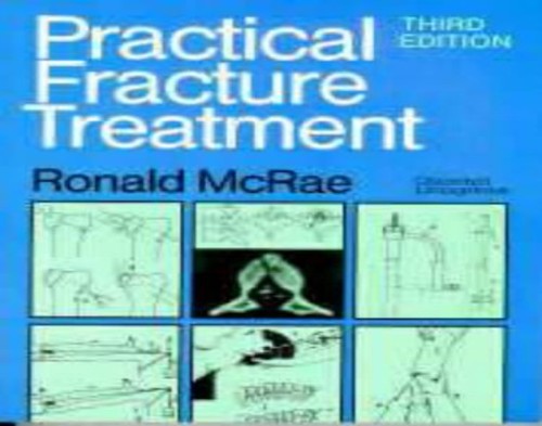 Practical Fracture Treatment