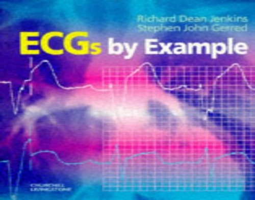 ECG's by Example