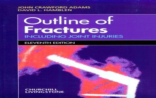 Outline of Fractures