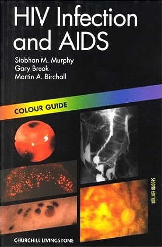 HIV Infection and Aids