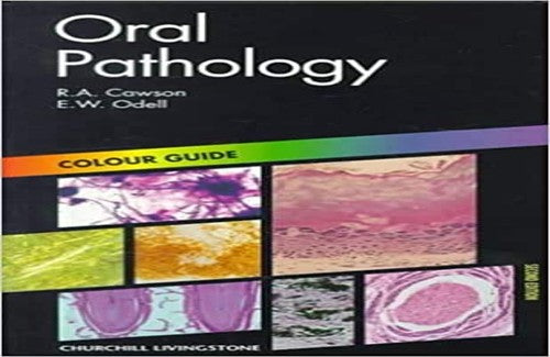 Oral Pathology