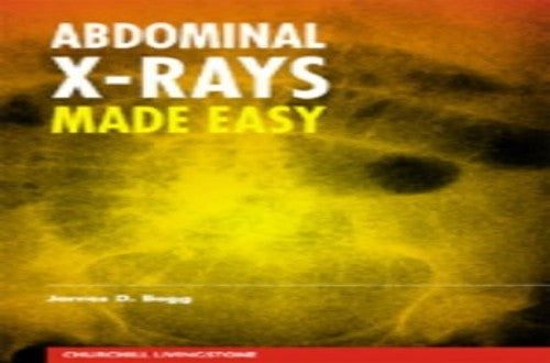 Abdominal X-rays Made Easy