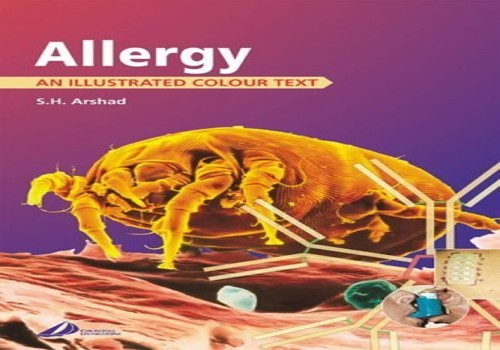 Allergy