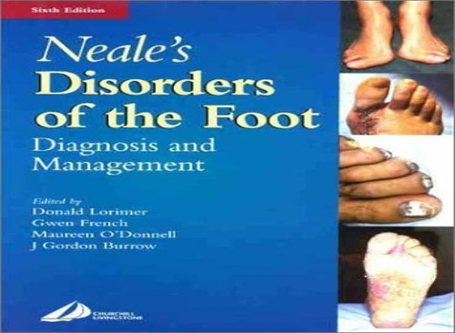 Disorders of the Foot