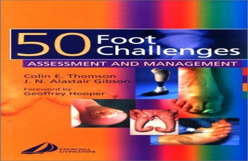 50 Foot Challenges