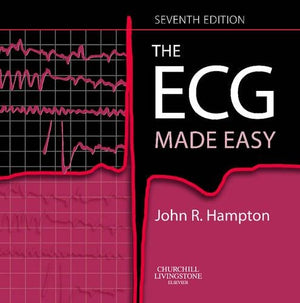 The ECG Made Easy