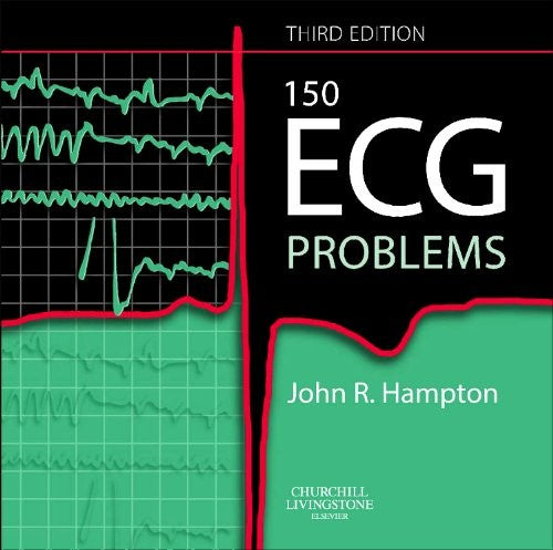 The ECG in Practice