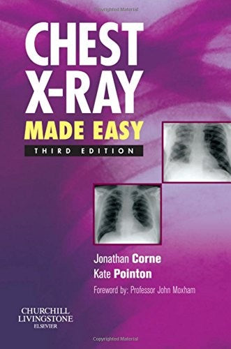 Chest X-Ray Made Easy
