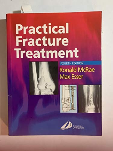 Practical Fracture Treatment