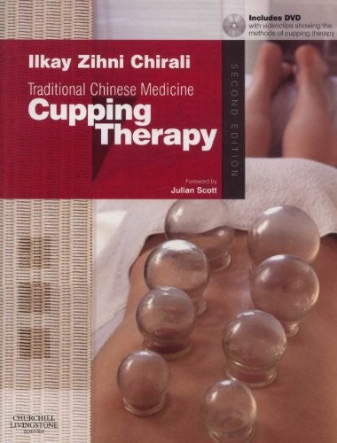 Traditional Chinese Medicine Cupping Therapy