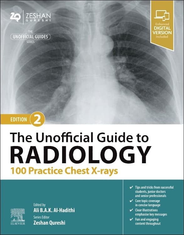 The Unofficial Guide to Radiology: 100 Practice Chest X-rays