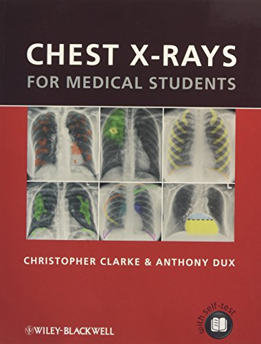 Chest X-rays for Medical Students
