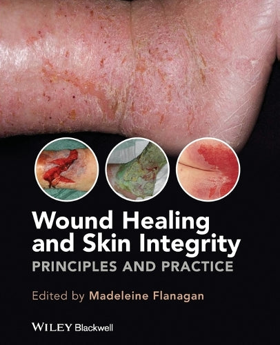 Wound Healing and Skin Integrity