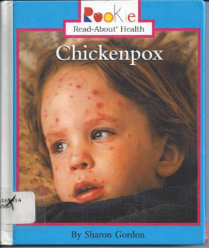 Chickenpox