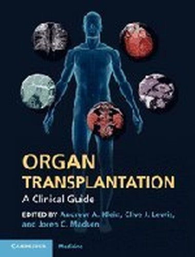 Organ Transplantation
