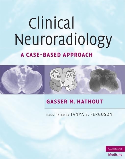 Clinical Neuroradiology