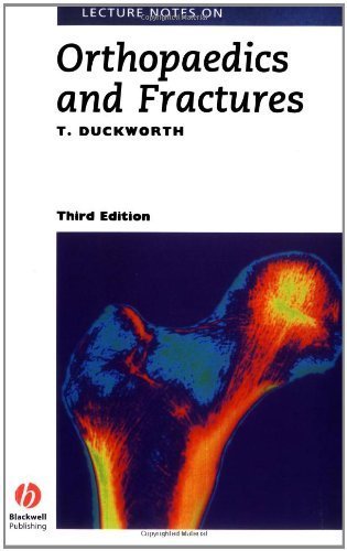 Lecture Notes on Orthopaedics and Fractures