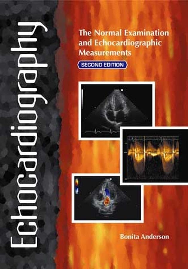 Echocardiography