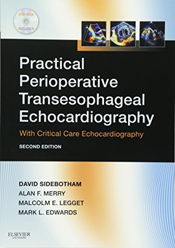 Practical Perioperative Transesophageal Echocardiography