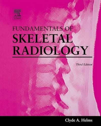 Fundamentals of Skeletal Radiology
