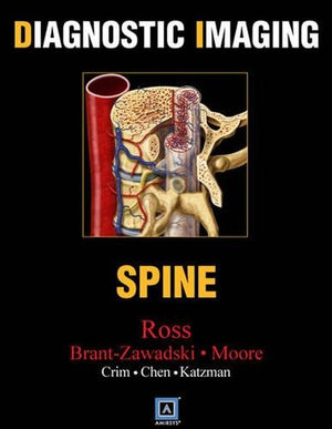 Spine
