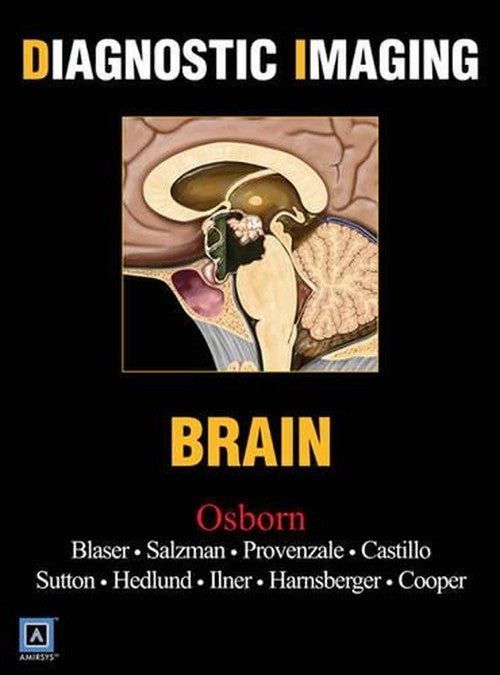 Brain