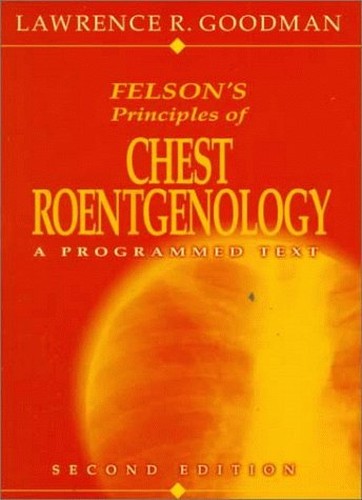 Felson's Principles of Chest Roentgenology