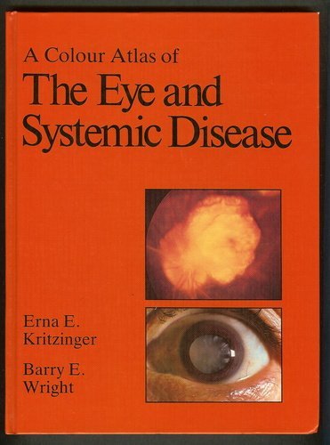 A Colour Atlas of the Eye and Systemic Diseases