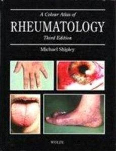 A Colour Atlas of Rheumatology
