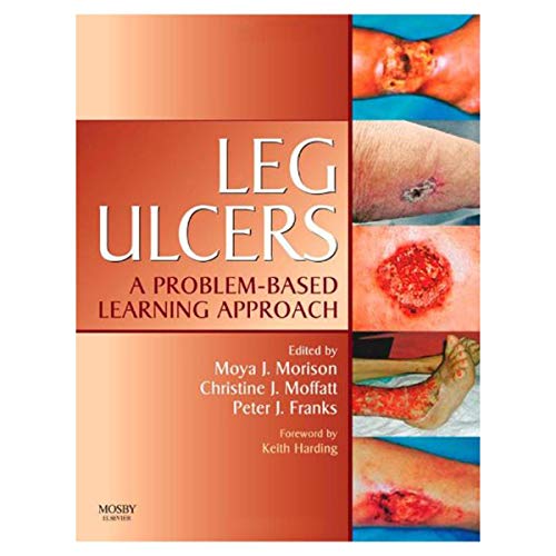 Leg Ulcers