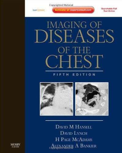 Imaging of Diseases of the Chest